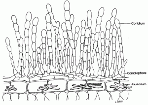 begonya külleme hastalığı